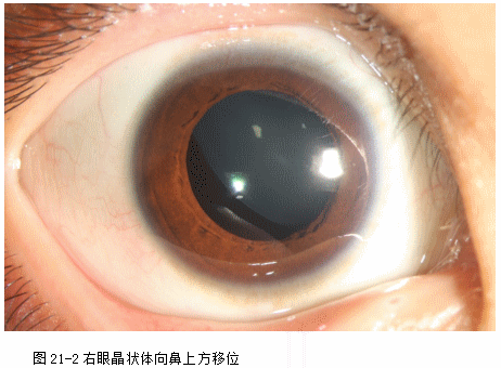 ZY016_107_3.gif